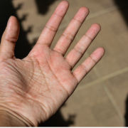 Palm of an adult's left hand